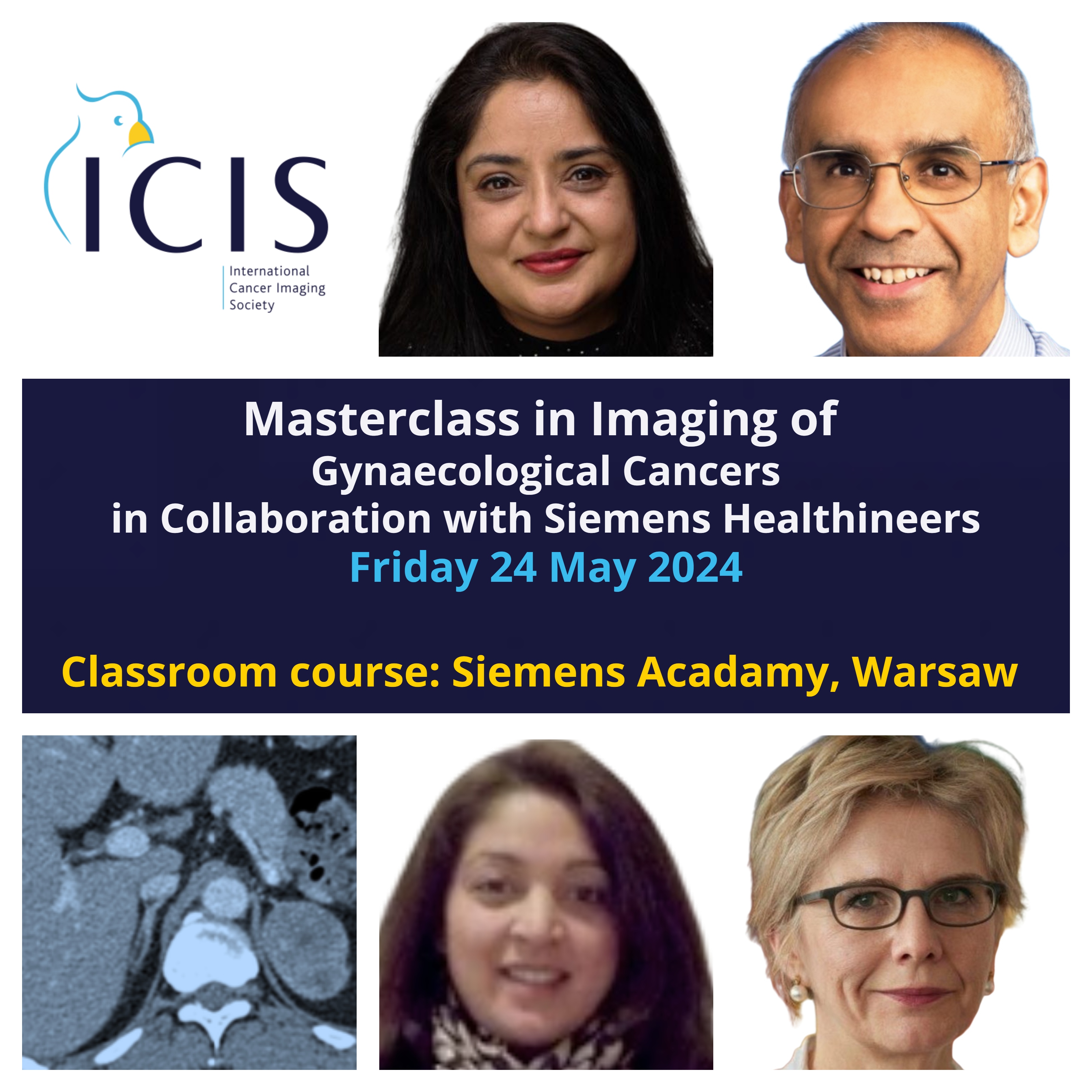 Masterclass in Imaging of Gynaecological Cancers, 2nd Edition